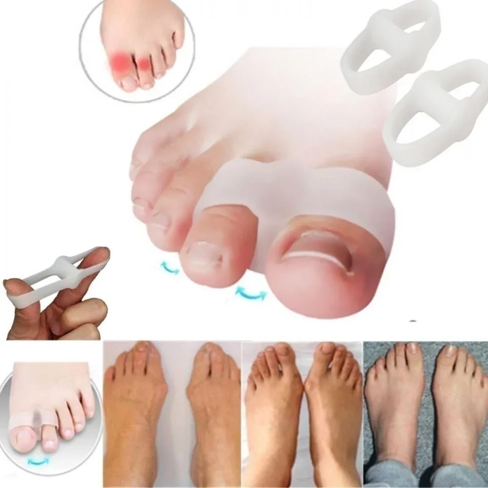 Pelurus Gel Pemisah Jari Kaki  - Correction Fluid White ulasan dan harga